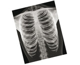 Röntgenbilder Mensch-Lieferzeit: ca. 2-3 Monate