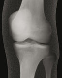 Röntgenbilder Mensch-Lieferzeit: ca. 2-3 Monate