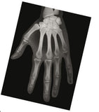 Röntgenbilder Mensch-Lieferzeit: ca. 2-3 Monate