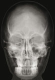 Röntgenbilder Mensch